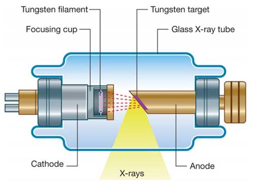 Plain Radiography